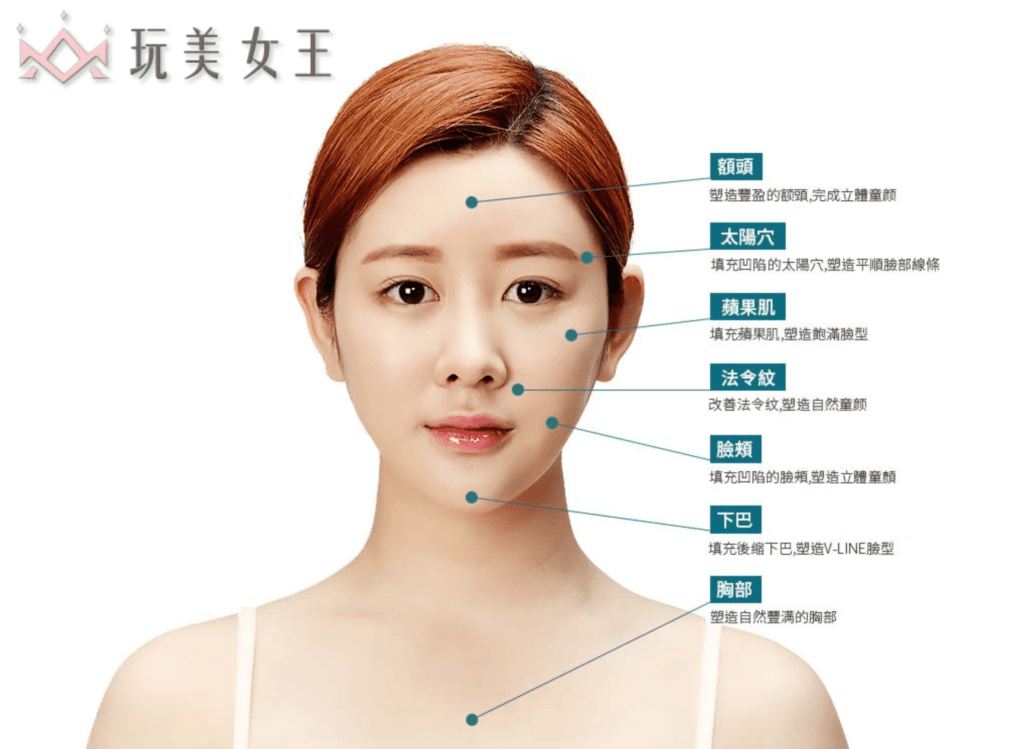 自體脂肪補臉位置 - 玩美女王 自體脂肪補臉位置